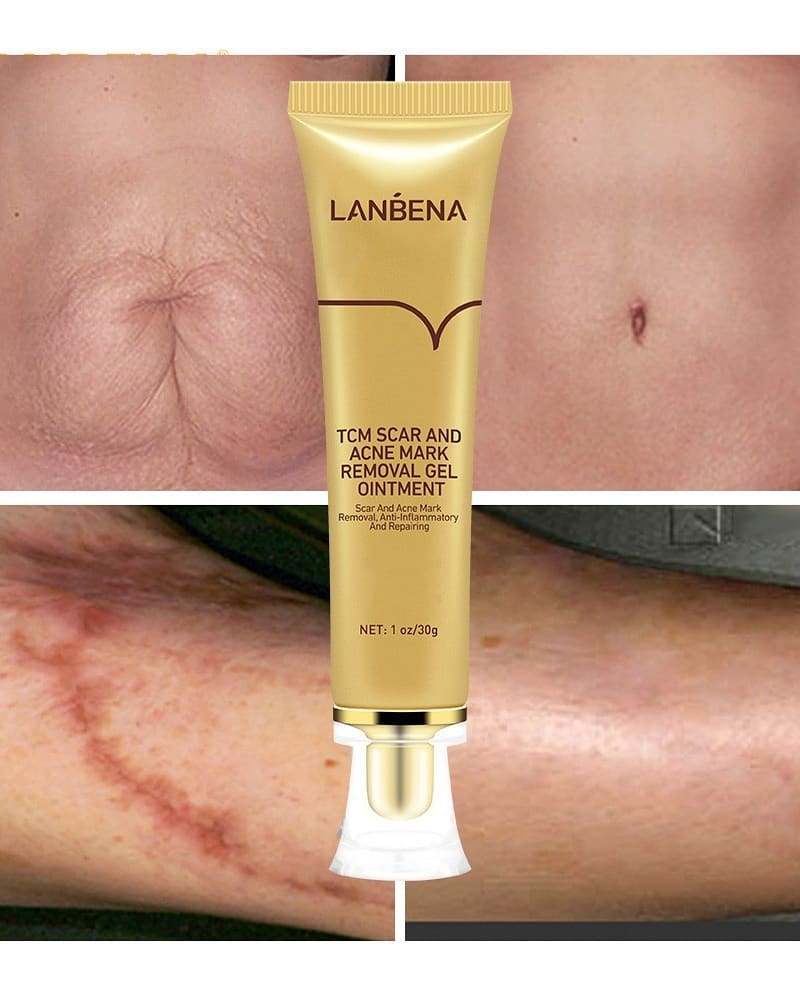 ژل ترمیم کننده اسکار و جای زخم لانبنا LANBENA